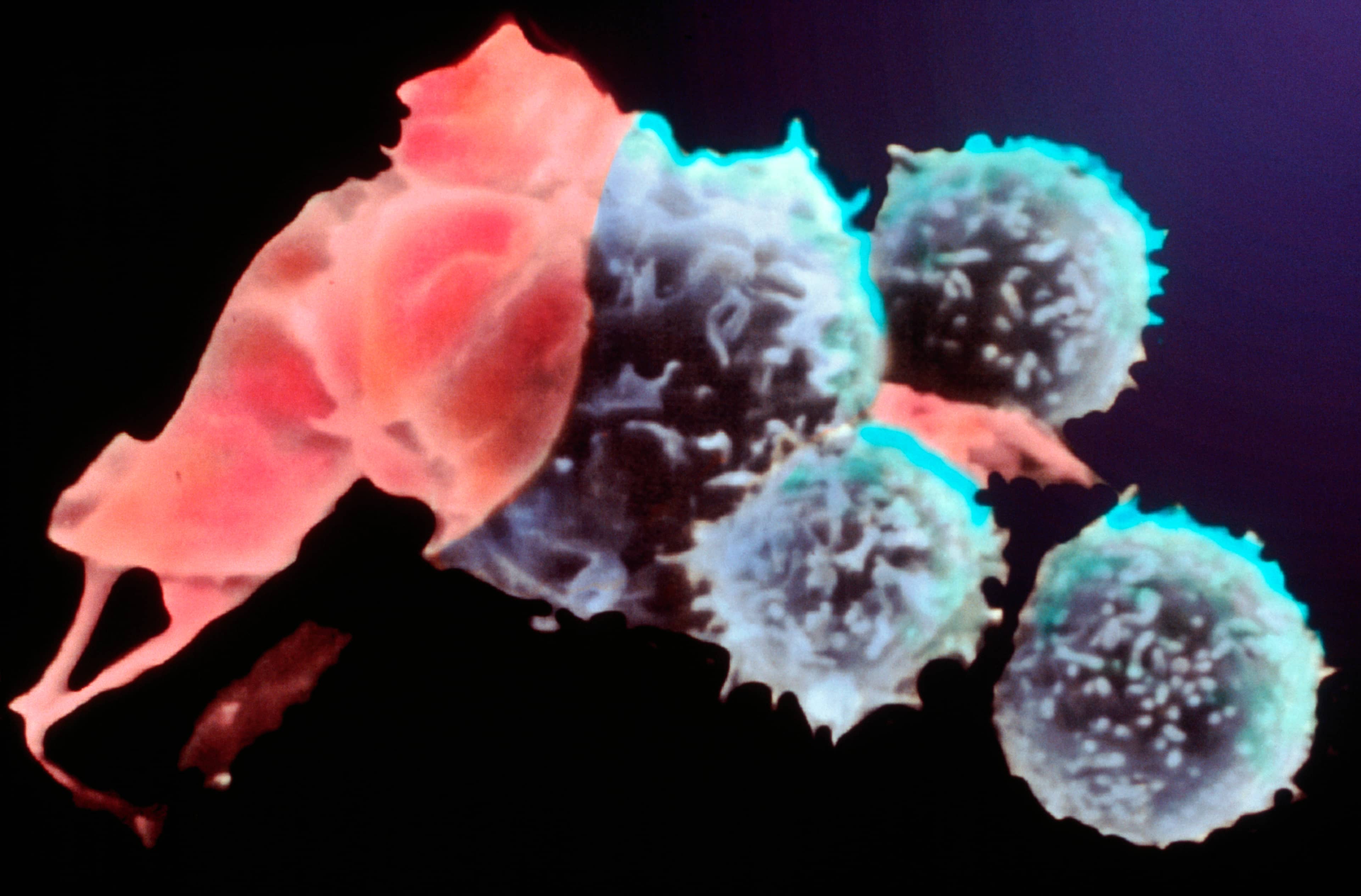 Image of Killer T cells (or cytotoxic T cells).